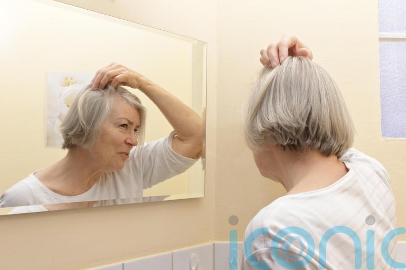 5 reasons you may be losing your hair and how to prevent it