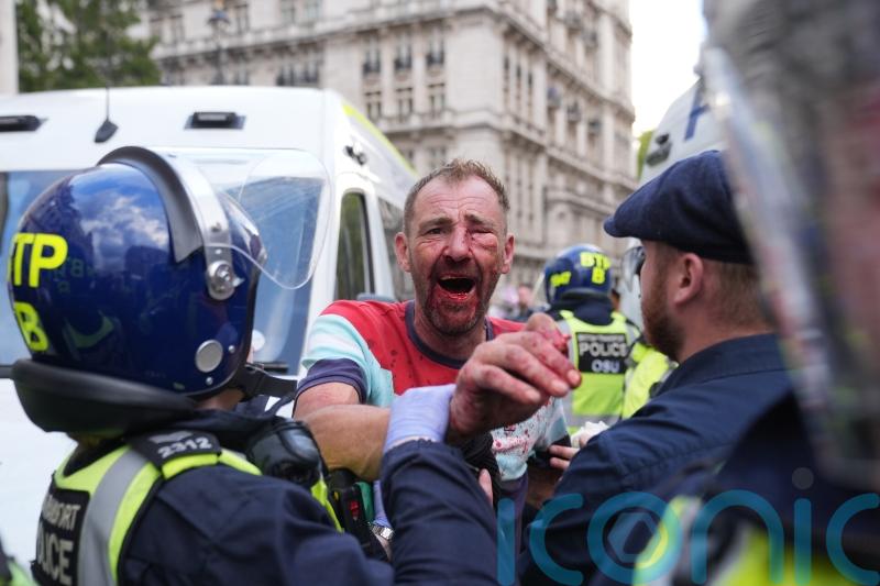 Police ‘assaulted’ and face ‘aggression’ from Tommy Robinson protesters