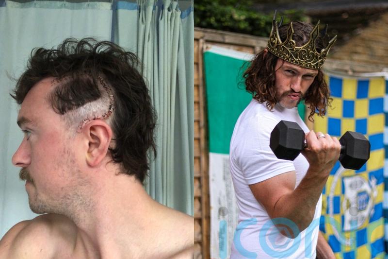 Man with terminal brain cancer makes it his ‘purpose in life’ to break record for most money raised by a marathon runner