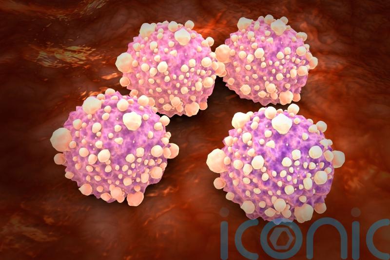 Mouth bacteria may increase pancreatic cancer risk threefold, experts say
