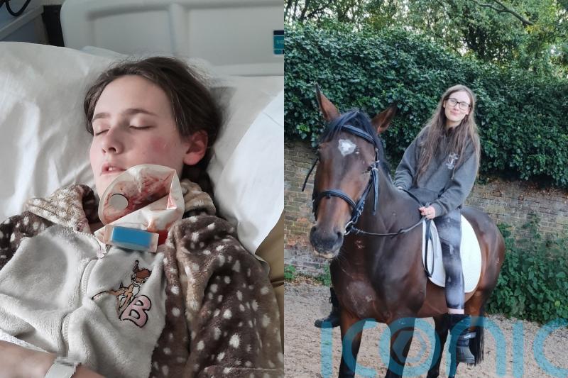 ‘Traumatised’ student receives £26k from dental practice after untreated decay led to abscess that nearly caused sepsis