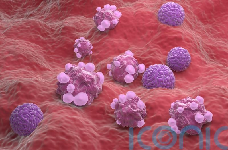 NHS hospital becomes first to offer new ovarian cancer surveillance test