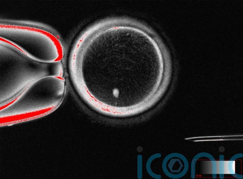 Scientists find way to fertilise eggs made from genetic material of skin cells
