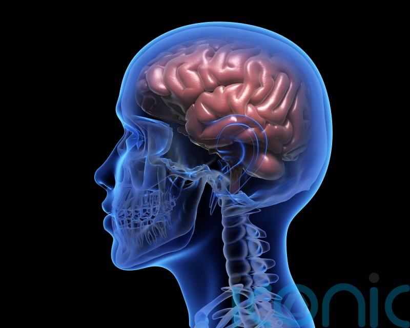 Scientists discover way to see tiny brain clusters that may trigger Parkinson’s