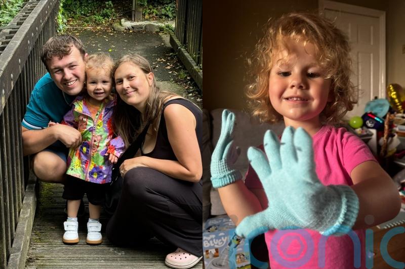 ‘Hopefully she will forget’ – Mother of girl, three, who lost fingers and toes to sepsis continues to ‘deal with trauma’