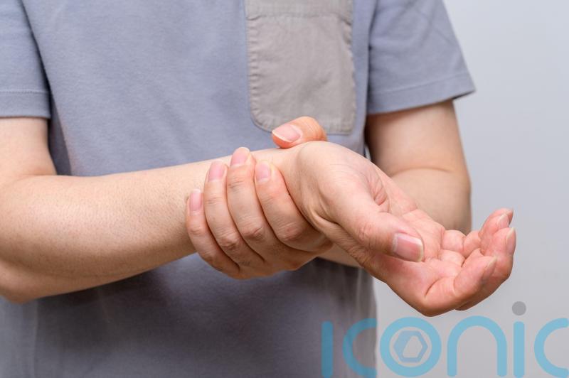 Arthritis ‘impacting people’s ability to work’