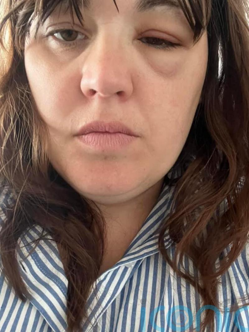 Patients with brain cancer express disappointment after drug rejected for NHS