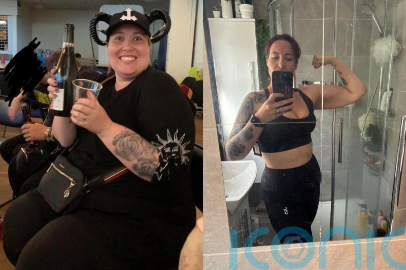 Woman who lost half her body weight after gastric band surgery says she now understands ‘thin privilege’