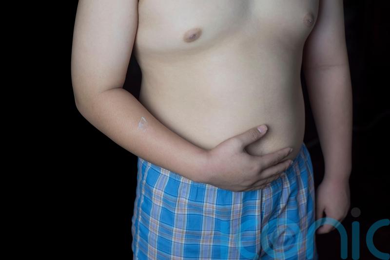 One in 10 children in first year of primary school in England is obese