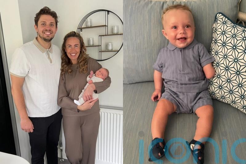 Parents whose unborn son’s hand was severed in womb by band of tissue are ‘relieved’ he was born ‘happy and healthy’