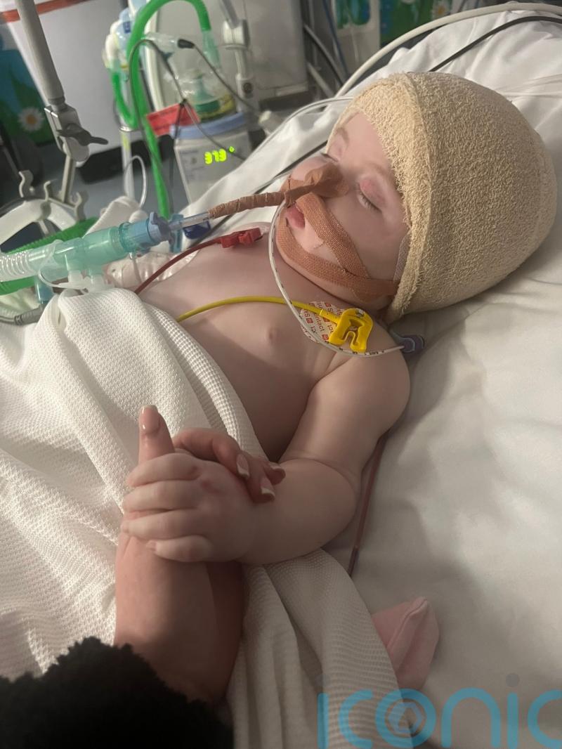 Baby diagnosed with brain tumour at three months enjoys first birthday at home