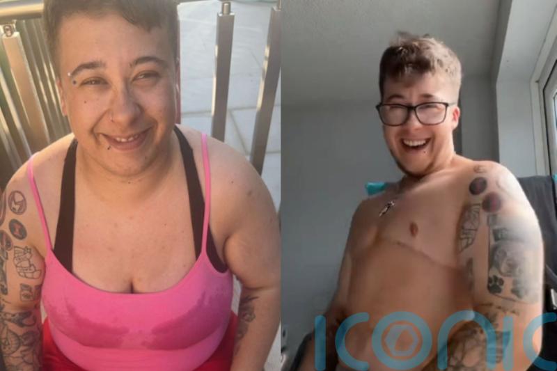 Trans man felt like he ‘won the lottery’ after having top surgery and getting the ‘dad bod’ he’d always wanted