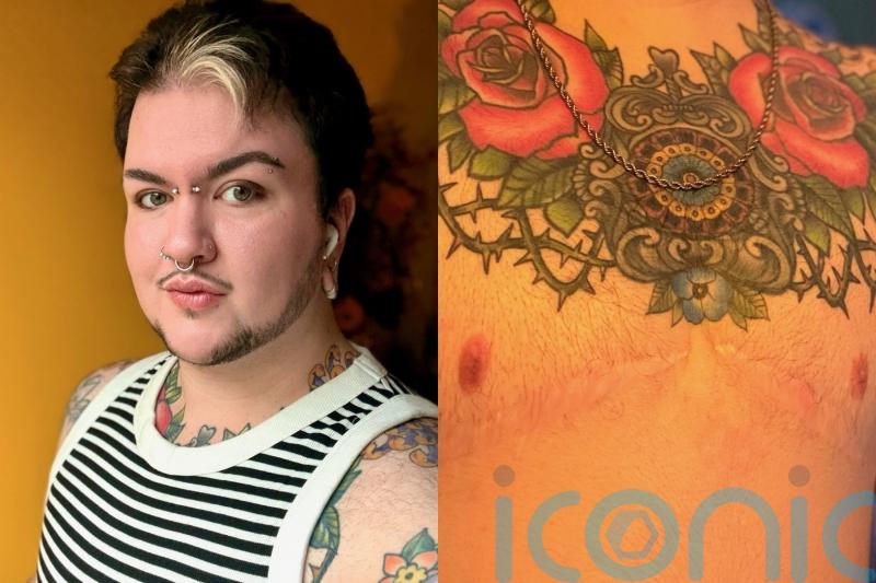 ‘I got 3D nipple tattoos after top surgery – now I can take my top off, it’s been a massive confidence boost’
