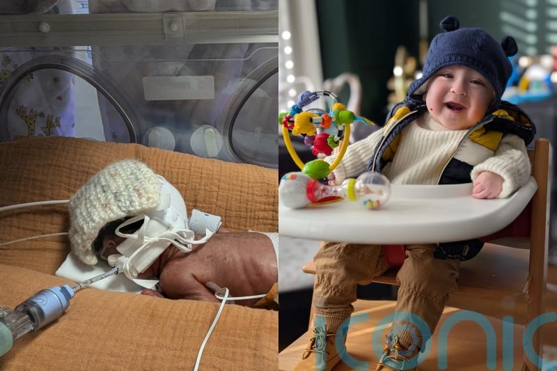 ‘Our baby was born at 23 weeks weighing 800g – we were repeatedly told he might not make it but he’s just turned one’