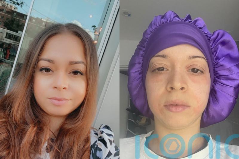 Mother believes she has &lsquo;overgrowth&rsquo; of skin&rsquo;s naturally occurring mites and feels them &lsquo;scurrying over her 24/7&rsquo;