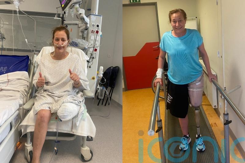 Mum who lost leg to flesh-eating disease after thinking she had cold making &lsquo;most of every opportunity&rsquo; with prosthetic
