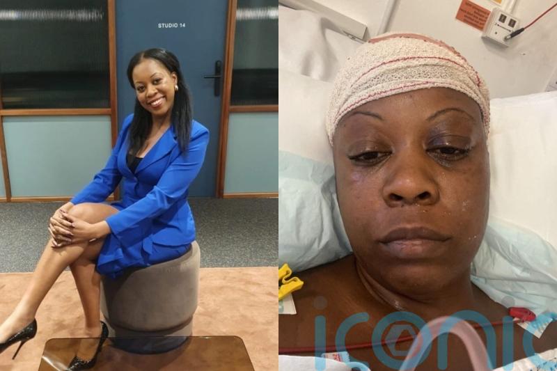 Woman, 40, who had two strokes thought she could &lsquo;live with&rsquo; high blood pressure but &lsquo;never imagined it would nearly kill me&rsquo;