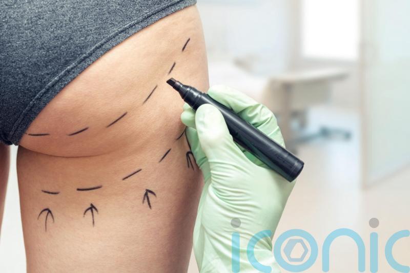 Government &lsquo;should immediately ban Brazilian butt lifts&rsquo;