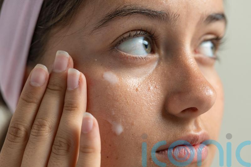 How to get rid of &lsquo;milk spots&rsquo;