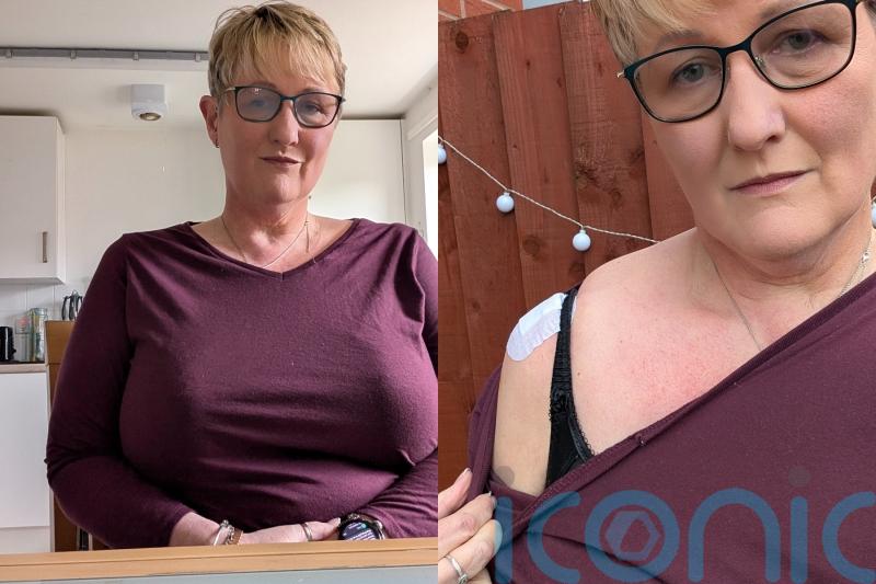 &lsquo;I hate my saggy 40K-cup breasts &ndash; the NHS has refused surgery at least 20 times, I&rsquo;m desperate to have my freedom back&rsquo;