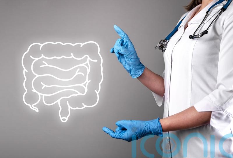 What can I expect during bowel cancer screening &ndash; and am I eligible?