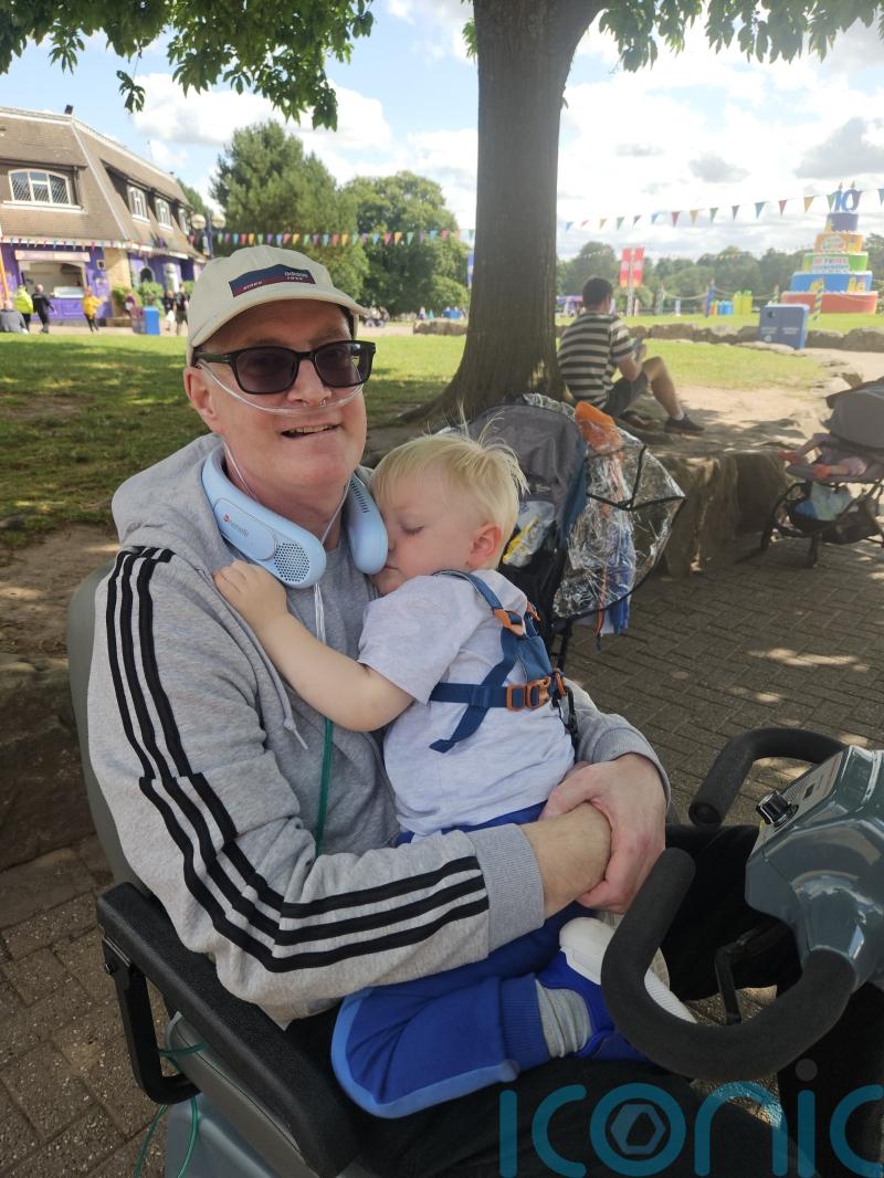 Skin patch from organ donor helped patient spot his new lung was being rejected